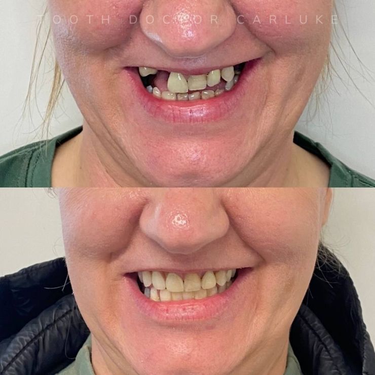 Transforming Smiles