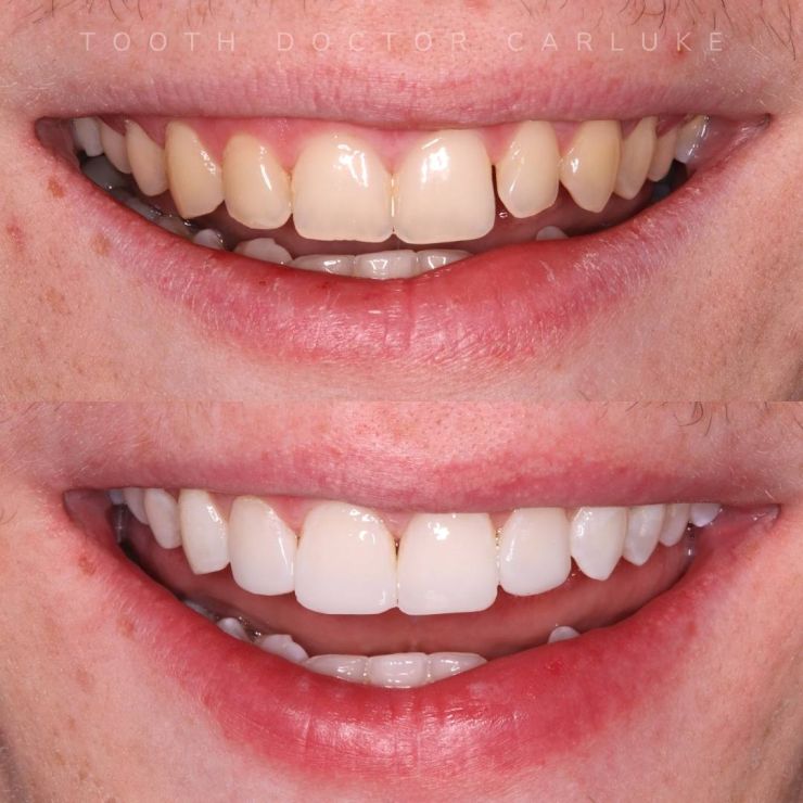 Transforming Smiles