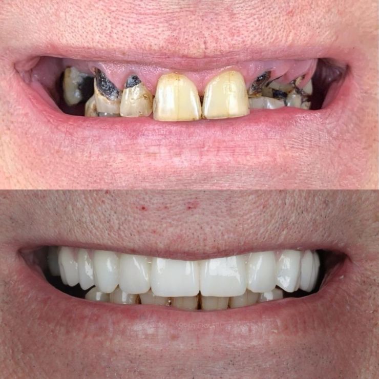 Transforming Smiles