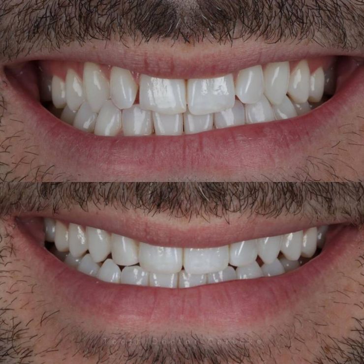 Transforming Smiles