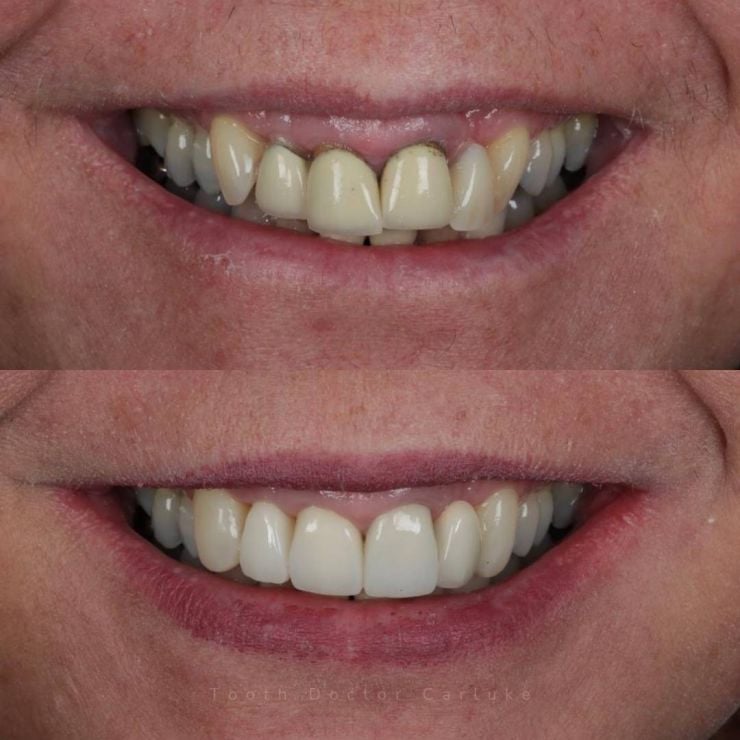 Transforming Smiles