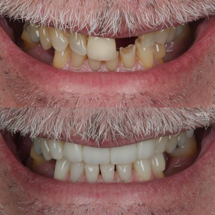 Transforming Smiles