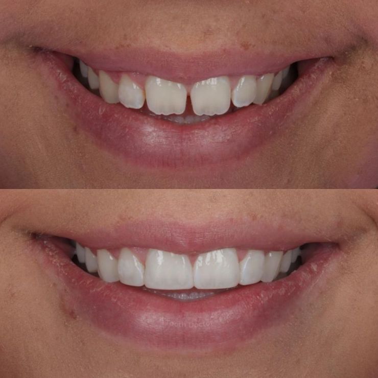 Transforming Smiles