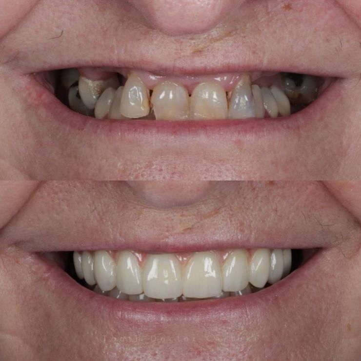 Transforming Smiles