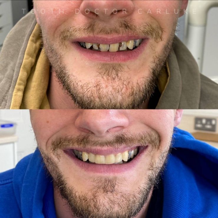 Transforming Smiles