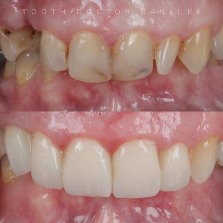 Transforming Smiles