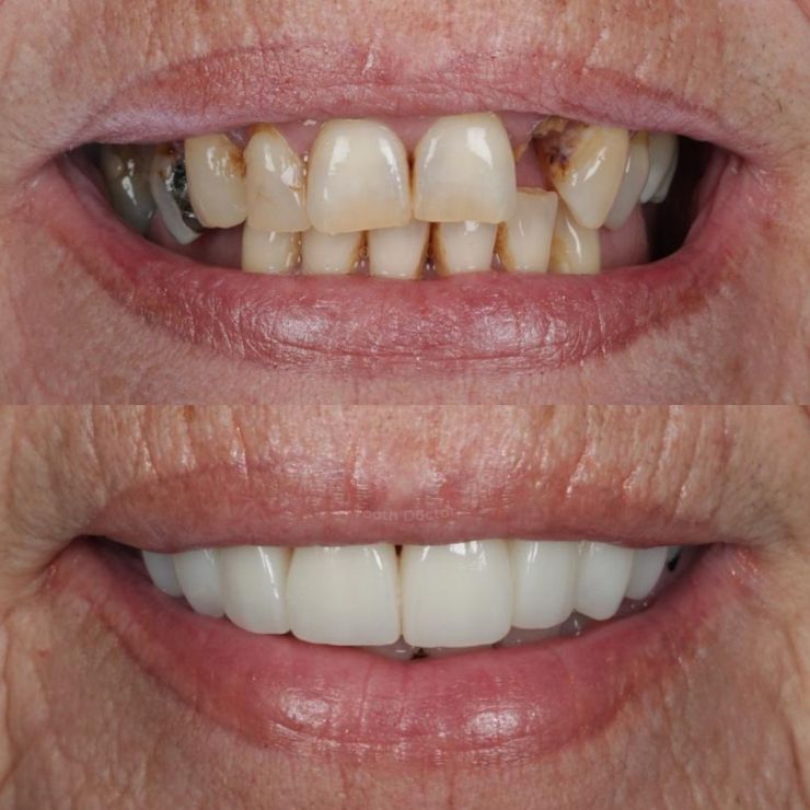 Transforming Smiles