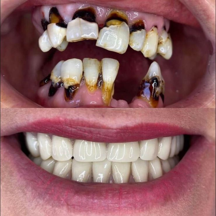 Transforming Smiles