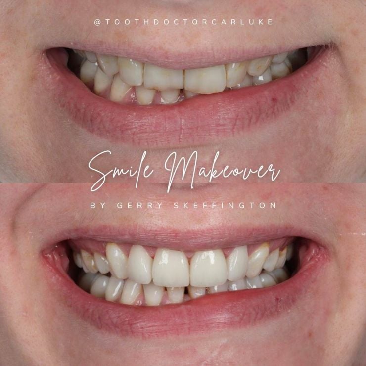 Transforming Smiles
