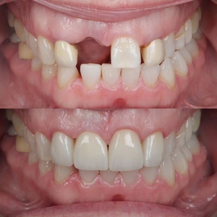 Transforming Smiles