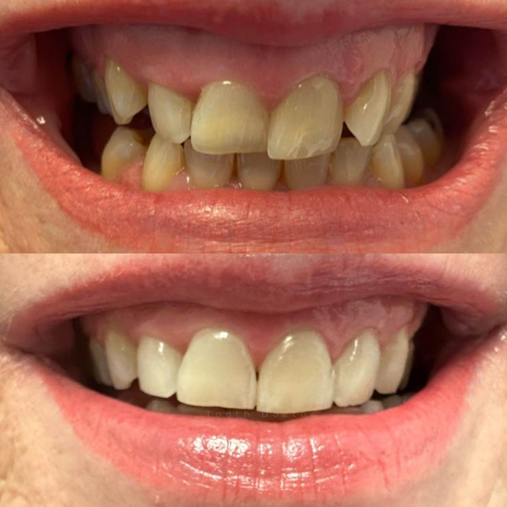 Transforming Smiles
