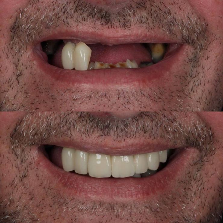 Transforming Smiles