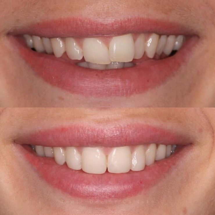 Transforming Smiles