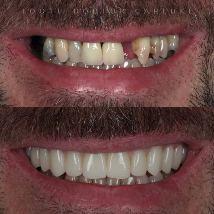 Transforming Smiles