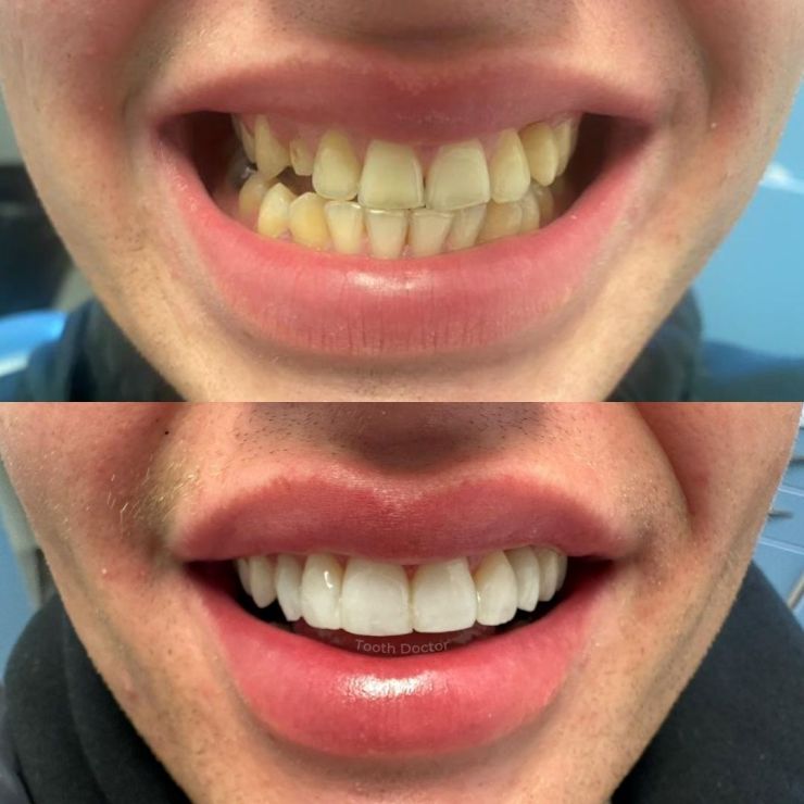 Transforming Smiles