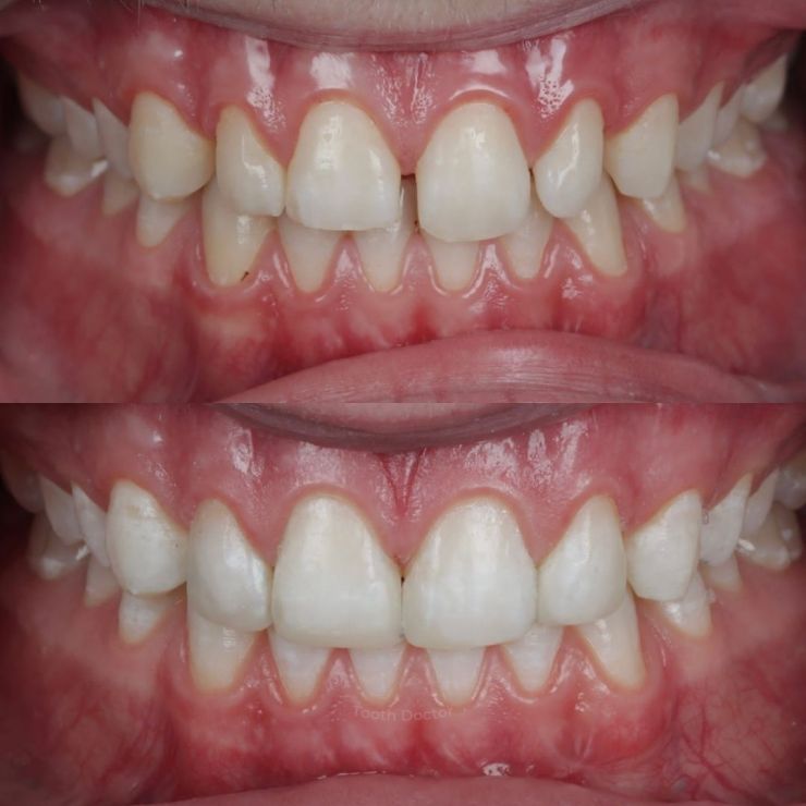 Transforming Smiles