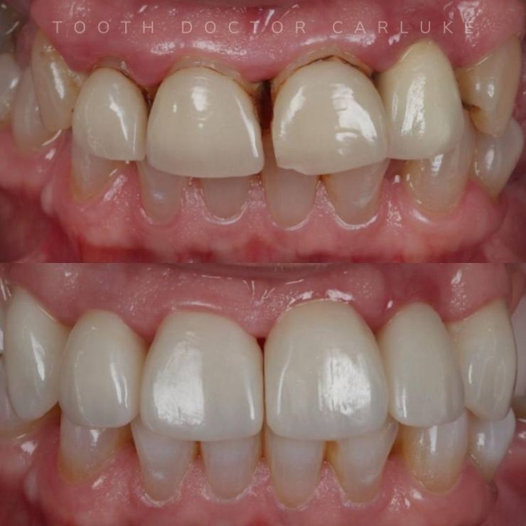 Transforming Smiles