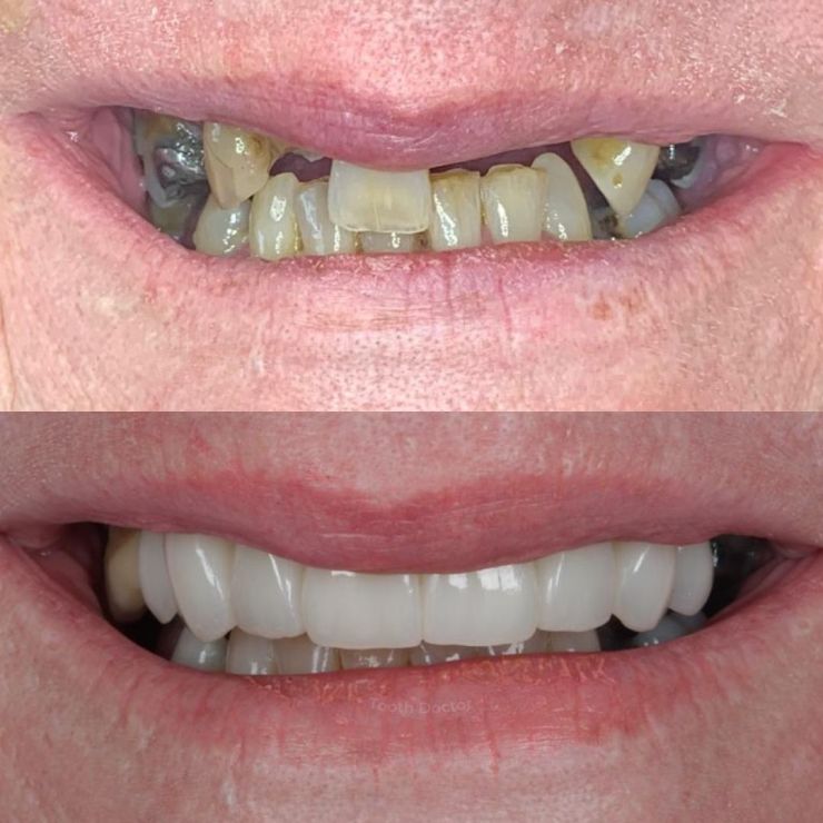 Transforming Smiles