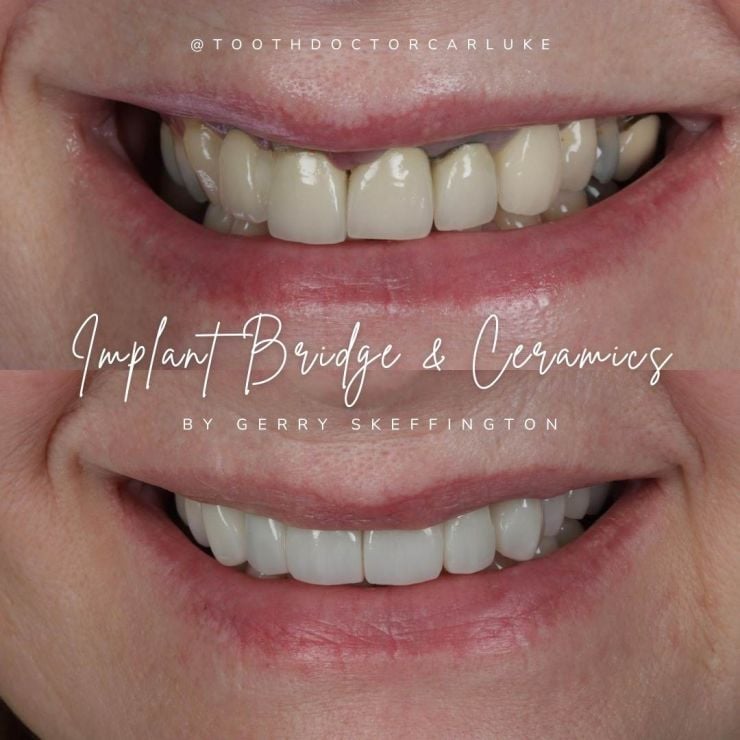 Transforming Smiles